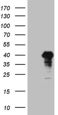 POU4F3 / BRN3C Antibody (aa179-338, clone OTI3A12, Carrier-free)