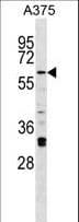 Polyclonal Rabbit anti-Mouse IRAK2 / IRAK-2 Antibody (aa594-622, WB)