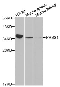 PathPlus™ PRSS1 / Trypsin Antibody