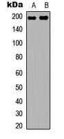 Polyclonal Rabbit anti-Human TOP2A / Topoisomerase II Alpha Antibody (Internal, IHC, WB)