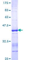 Human ZBTB33 / Kaiso Protein (Recombinant GST, N-terminus)