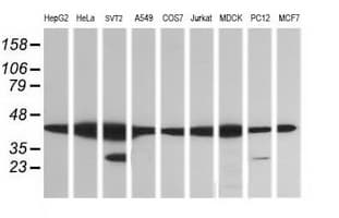 MAP2K1 / MKK1 / MEK1 Antibody (clone OTI7B1)