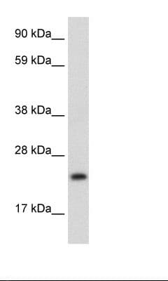 ASCL1 / MASH1 Antibody (aa48-97)