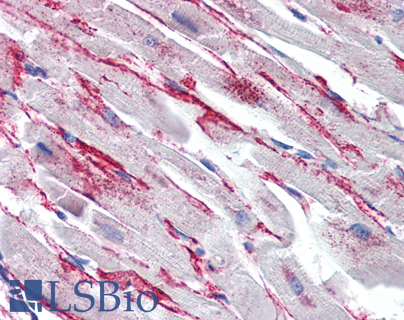 IHC-plus™ Polyclonal Rabbit anti-Human FPR2 / FPRL1 Antibody (C-Terminus, IHC, IF, WB)