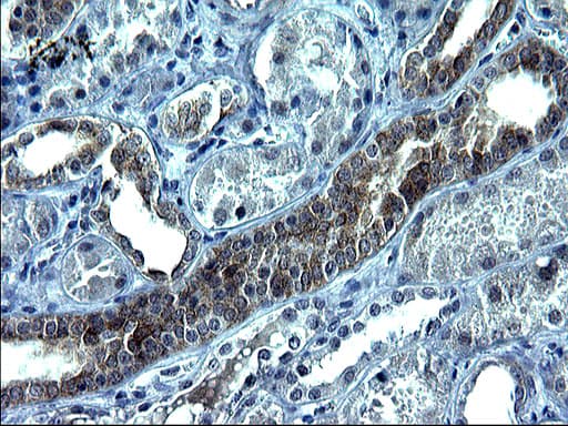 Monoclonal Mouse anti-Human VEGFB Antibody (clone OTI2C4, IHC, WB)
