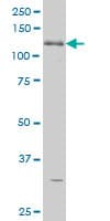 Monoclonal Mouse anti-Human ABL2 Antibody (clone 5C6, IF, WB)