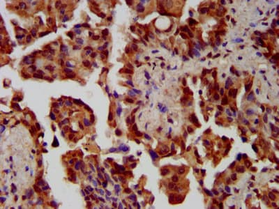 Polyclonal Rabbit anti-Human NEK1 Antibody (IHC, IF)