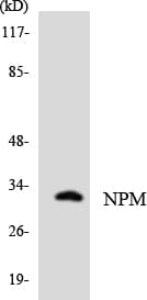 NPM1 / NPM / Nucleophosmin Antibody (aa181-230)