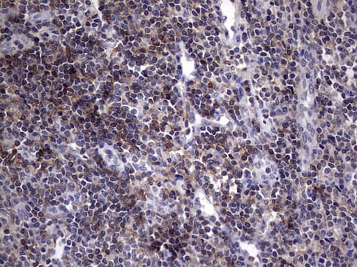 AKAP7 Antibody (clone OTI6F7)