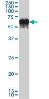 IHC-plus™ Monoclonal Mouse anti-Human G3BP1 / G3BP Antibody (clone 2F3, IHC, IF, WB)