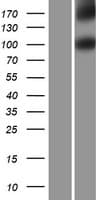 IL17RD Protein (Over-Expression Lysate Myc-DDK (Flag))
