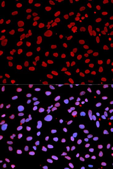 IFIH1 / MDA5 Antibody