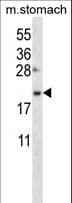 Polyclonal Rabbit anti-Human OSTC Antibody (aa90-117, WB)