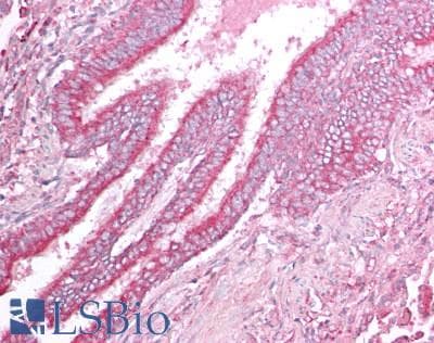 IHC-plus™ VISA / MAVS Antibody (aa1-65)