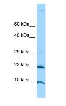 ADAT2 Antibody (aa33-82)