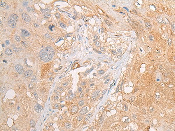 Polyclonal Rabbit anti-Human PCDHGB5 Antibody (IHC)