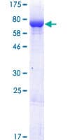 Human DUS1L Protein (Recombinant GST)
