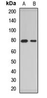 ACSL4 / FACL4 Antibody