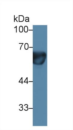 PRLR / Prolactin Receptor Antibody (aa25-234)