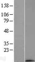 MRPL33 Protein (Over-Expression Lysate Myc-DDK (Flag))