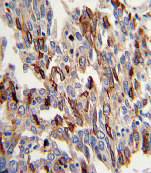 Polyclonal Rabbit anti-Human PECAM-1 / CD31 Antibody (aa690-718, IHC, WB)