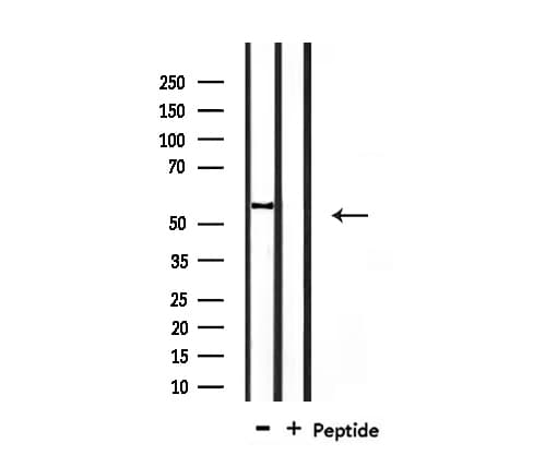 Polyclonal Rabbit anti-Human SMAD1 Antibody (IF, WB)