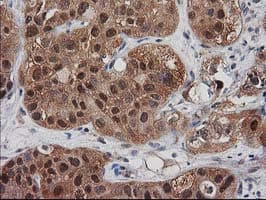 DSTN / Destrin Antibody (clone OTI1D5)