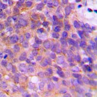 Polyclonal Rabbit anti-Human KCNAB3 Antibody (C-Terminus, IHC, WB)