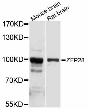 ZFP28 Antibody