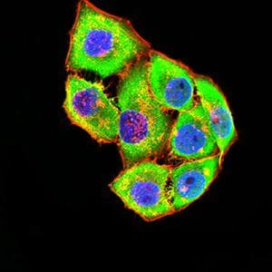 Monoclonal Mouse anti-Human GRIK4 / KA1 Antibody (clone 8H5G5, IHC, WB)