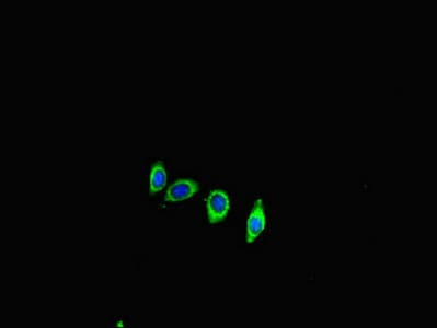 ACE2 / ACE-2 Antibody