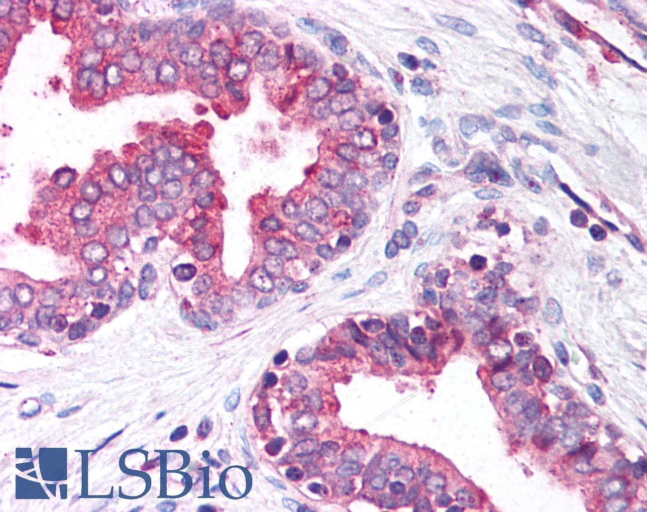PathPlus™ CALR / Calreticulin Antibody