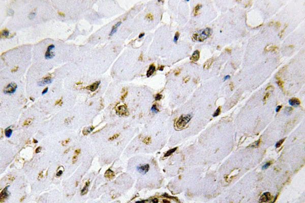 Polyclonal Rabbit anti-Human CDK2 Antibody (Gln265, IHC, WB)