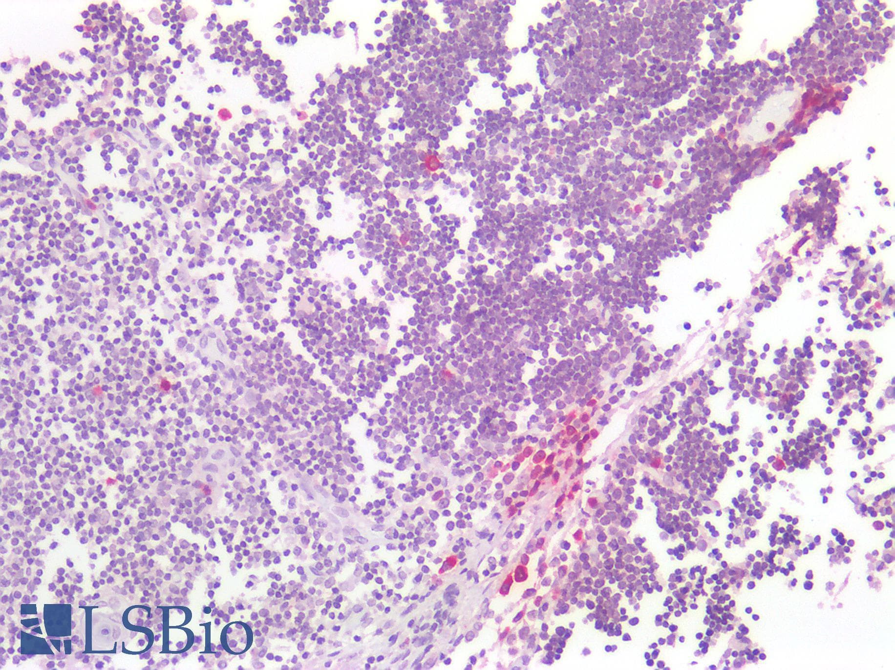PathPlus™ HNE / Neutrophil Elastase Antibody