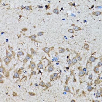 SMAD5 Antibody