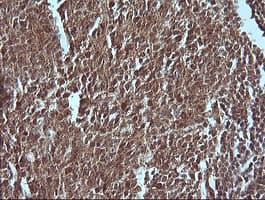 MAP2K1 / MKK1 / MEK1 Antibody (clone OTI2A9)
