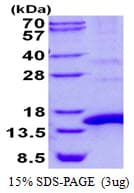 Human POLR2J Protein (Recombinant His)
