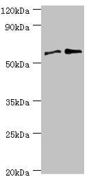 PPP3CC / CALNA3 Antibody (aa373-512)