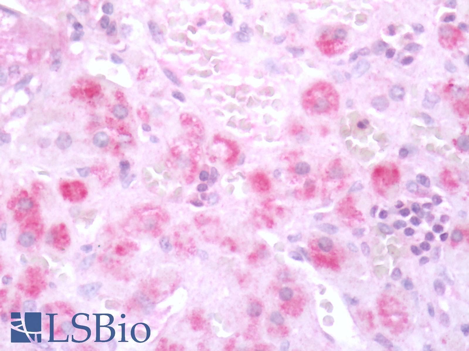 PathPlus™ Polyclonal Rabbit anti-Human HTR7 / 5HT7 Receptor Antibody (C-Terminus, IHC)