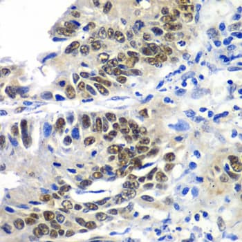 Polyclonal Rabbit anti-Human DACH / DACH1 Antibody (IHC, WB)