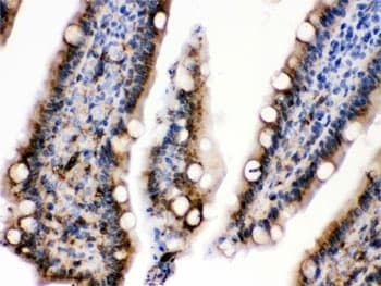 KRT19 / CK19 / Cytokeratin 19 Antibody