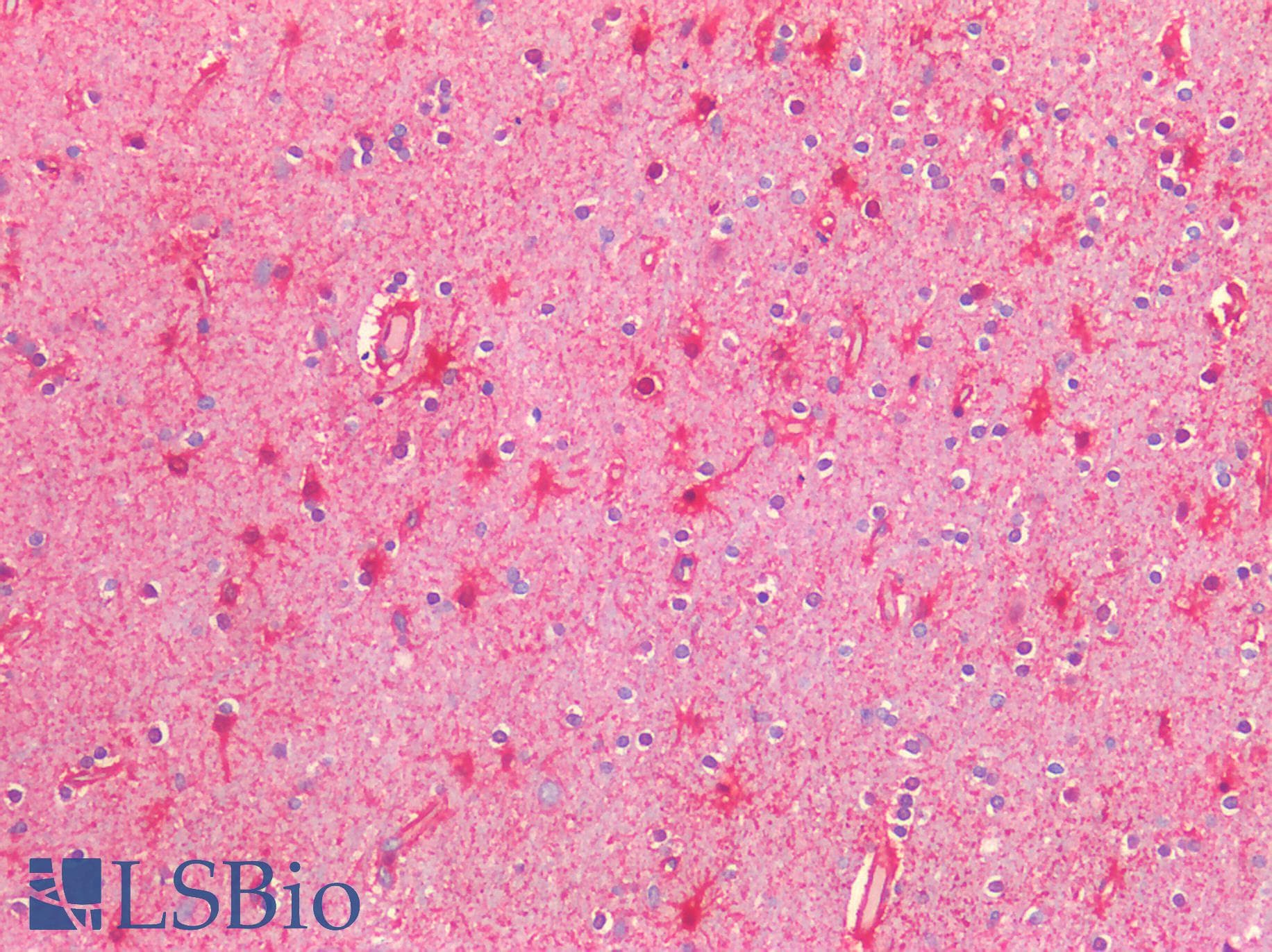 PathPlus™ NOS2 / iNOS Antibody