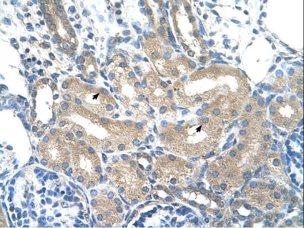ADH2 / ADH1B Antibody (aa301-350)