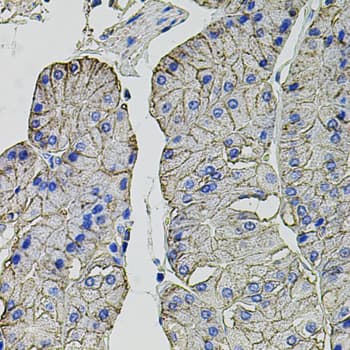 IHC-plus™ Polyclonal Rabbit anti-Human CA9 / Carbonic Anhydrase IX Antibody (IHC, WB)