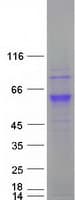 Human CCT6A Protein (Recombinant Myc-DDK (Flag))