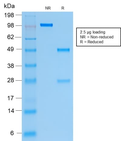 PathPlus™ KRT19 / CK19 / Cytokeratin 19 Antibody (clone rKRT19/799)