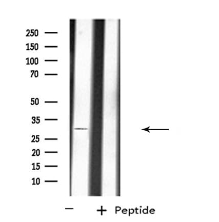 ATP1B3 Antibody