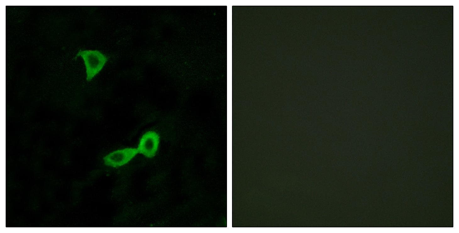 GRM2 / MGLUR2 Antibody