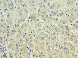 ADH1C Antibody (aa1-375)