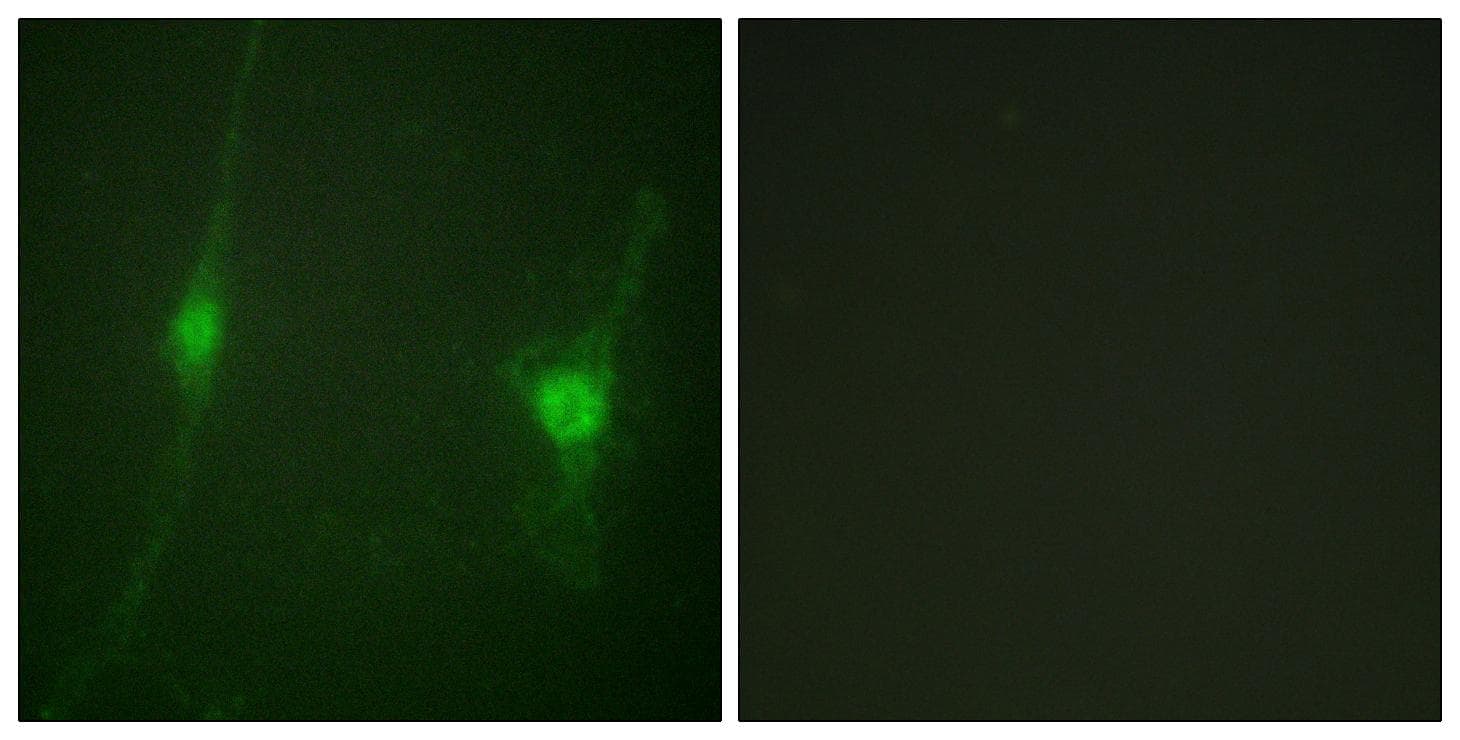 STK11 / LKB1 Antibody (Ab-428)